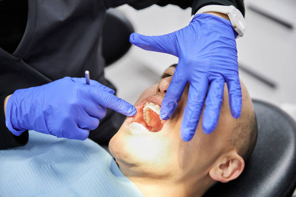 Best Dentist for Tooth Abscess  in Drexel, NC